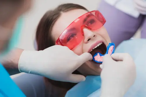 Flouride Treatments - Kid Grins Flouride Treatments - Kid Grins