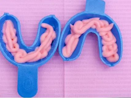 Types of Topical Fluoride - Kid Grins