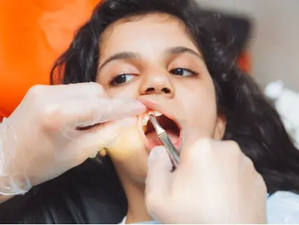 What to Expect During a Pediatric Tooth Extraction - At Kid Grins they will be able to explain