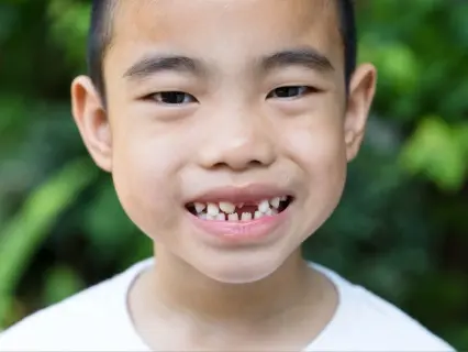Why Broken Baby Teeth Are a Dental Emergency - Kid Grins